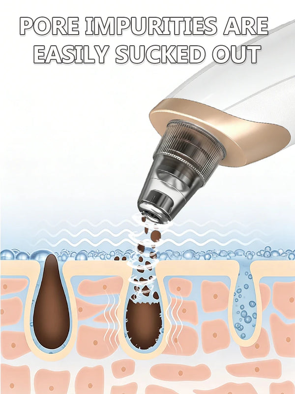 Hot-sale-Blackhead-Remover-Pore-Cleaner-Skin-Pimple-Acne-Extractor-Facial-Cleaning-Electric-Black-Head-Removal.jpg