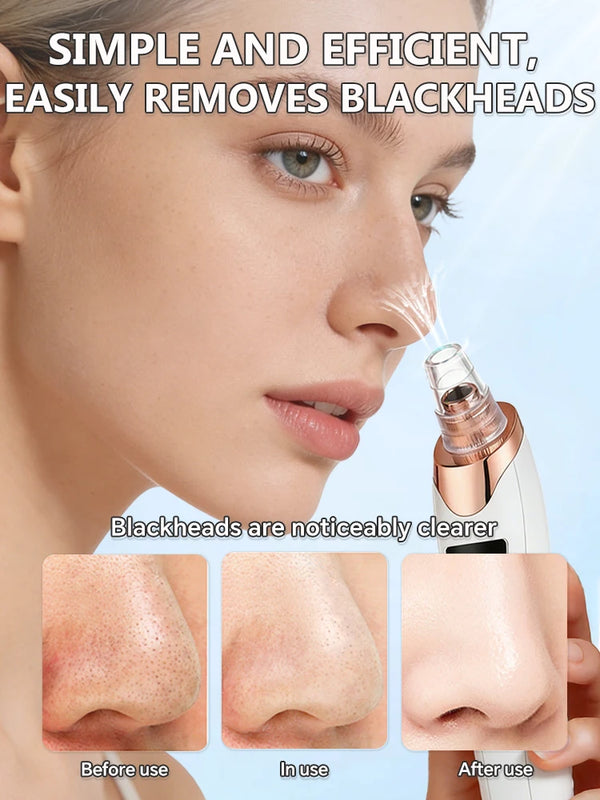 Ultimate Pore Cleanser Device